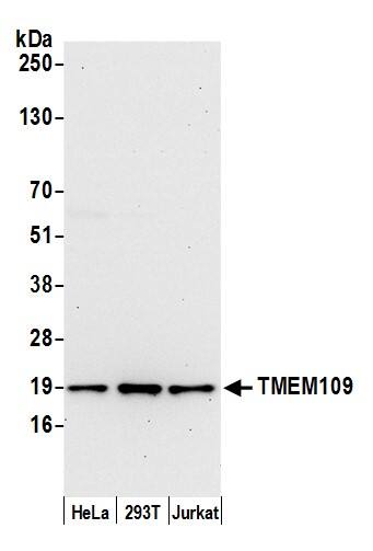 Western Blot;TMEM109 Antibody  Whole cell lysate (15 µg) from HeLa, HEK293T, and Jurkat cells prepared using NETN lysis buffer. Antibody: Affinity purified rabbit anti-TMEM109 antibody  used for WB at 0.1 mg/ml. Detection: Chemiluminescence with an exposure time of 30 seconds.