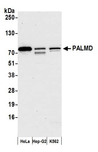 Western Blot;PALMD Antibody  Whole cell lysate (15 µg) from HeLa, Hep-G2, and K562 cells prepared using NETN lysis buffer. Antibody: Affinity purified rabbit anti-PALMD antibody  used for WB at 0.04 mg/ml. Detection: Chemiluminescence with an exposure time of 30 seconds.