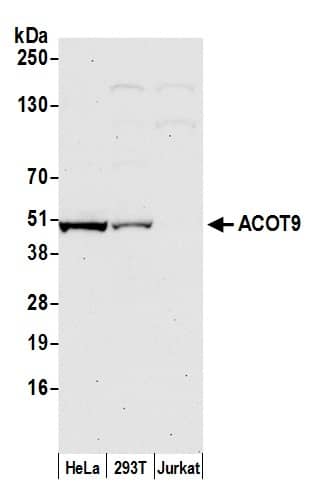 Western Blot;CGI-16 Antibody  Whole cell lysate (50 µg) from HeLa, HEK293T, and Jurkat cells prepared using NETN lysis buffer. Antibody: Affinity purified rabbit anti-ACOT9 antibody  used for WB at 0.04 mg/ml. Detection: Chemiluminescence with an exposure time of 30 seconds.