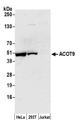 Western Blot;CGI-16 Antibody  Whole cell lysate (50 µg) from HeLa, HEK293T, and Jurkat cells prepared using NETN lysis buffer. Antibody: Affinity purified rabbit anti-ACOT9 antibody  used for WB at 0.04 mg/ml. Detection: Chemiluminescence with an exposure time of 30 seconds.