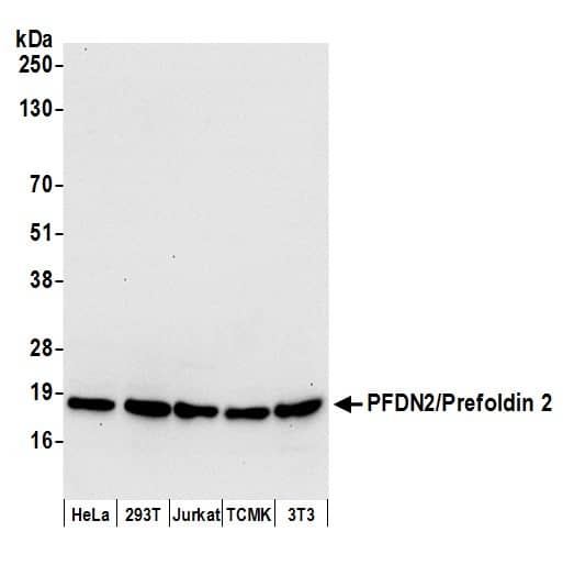 Western Blot TRAPPC5 Antibody