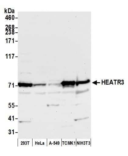 Western Blot;HEATR3 Antibody  Whole cell lysate (50 µg) from HEK293T, HeLa, A-549, mouse TCMK-1, and mouse NIH 3T3 cells prepared using NETN lysis buffer. Antibody: Affinity purified rabbit anti-HEATR3 antibody  used for WB at 0.04 mg/ml. Detection: Chemiluminescence with an exposure time of 10 seconds.