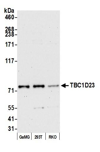 Western Blot;TBC1D23 Antibody  Whole cell lysate (15 µg) from GaMG, HEK293T, and RKO cells prepared using NETN lysis buffer. Antibody: Affinity purified Rabbit anti-TBC1D23 antibody  used for WB at 0.04 mg/ml. Secondary: HRP-conjugated goat anti-rabbit IgG (A120-101P). Detection: Chemiluminescence with an exposure time of 75 seconds.
