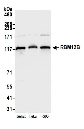 Western Blot;RBM12B Antibody  Whole cell lysate (10 µg) from Jurkat, HeLa, and RKO cells prepared using NETN lysis buffer. Antibody: Affinity purified rabbit anti-RBM12B antibody  used for WB at 0.04 mg/ml. Detection: Chemiluminescence with an exposure time of 1 second.
