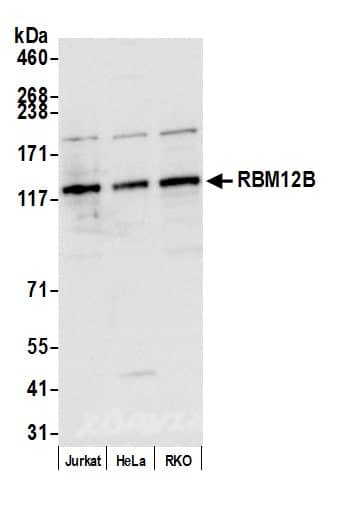 Western Blot;RBM12B Antibody  Whole cell lysate (10 µg) from Jurkat, HeLa, and RKO cells prepared using NETN lysis buffer. Antibody: Affinity purified rabbit anti-RBM12B antibody  used for WB at 0.04 mg/ml. Detection: Chemiluminescence with an exposure time of 1 second.