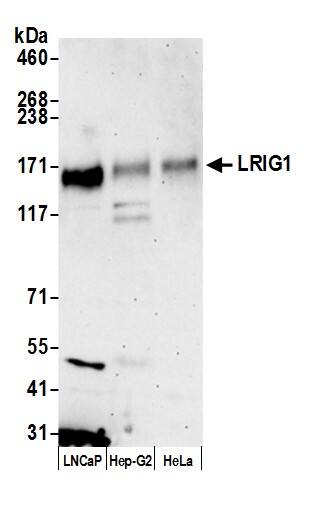 Western Blot;LRIG1 Antibody  Whole cell lysate (50 µg) from LNCaP, Hep-G2, and HeLa cells prepared using NETN lysis buffer. Antibody: Affinity purified rabbit anti-LRIG1 antibody  used for WB at 0.1 mg/ml. Detection: Chemiluminescence with an exposure time of 75 seconds.