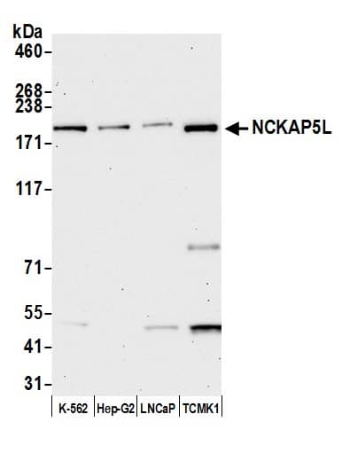 Immunoprecipitation;NCKAP5L Antibody  Whole cell lysate (10 µg) from K-562, Hep-G2, LNCaP, and TCMK-1 cells prepared using NETN lysis buffer. Antibody: Affinity purified rabbit anti-NCKAP5L antibody used for WB at 0.04 mg/ml. Detection: Chemiluminescence with an exposure time of 30 seconds.