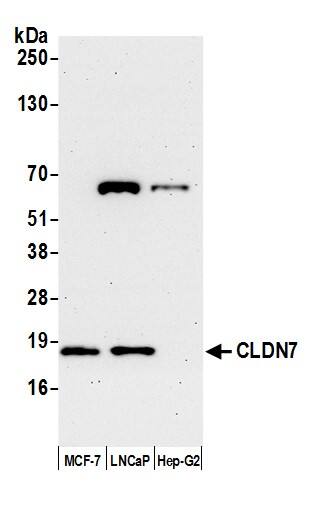 Immunoprecipitation;Claudin-7 Antibody  Whole cell lysate (15 µg) from MCF-7, LNCaP, and Hep-G2 cells prepared using NETN lysis buffer. Antibody: Affinity purified rabbit anti-CLDN7 antibody used for WB at 0.1 mg/ml. Detection: Chemiluminescence with an exposure time of 75 seconds.