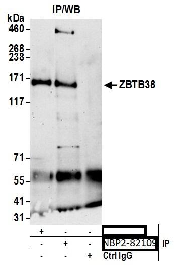 Immunoprecipitation;ZBTB38 Antibody  Whole cell lysate (1.0 mg per IP reaction; 20% of IP loaded) from K-562 cells prepared using NETN lysis buffer. Antibodies: Affinity purified rabbit anti-ZBTB38 antibody  used for IP at 2 µg per reaction. ZBTB38 was also immunoprecipitated by rabbit anti-ZBTB38 antibody. For bting immunoprecipitated ZBTB38,  was used at 0.1 mg/ml. Detection: Chemiluminescence with an exposure time of 75 seconds.