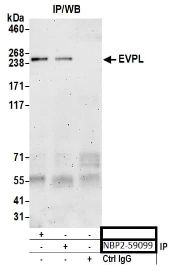 Immunoprecipitation;EVPL Antibody  Whole cell lysate (0.5 or 1.0 mg per IP reaction; 20% of IP loaded) from HeLa cells prepared using NETN lysis buffer. Antibodies: Affinity purified rabbit anti-EVPL antibody  used for IP at 6 µg per reaction. EVPL was also immunoprecipitated by rabbit anti-EVPL antibody. For bting immunoprecipitated EVPL, was used at 0.4 mg/ml. Detection: Chemiluminescence with an exposure time of 3 minutes.