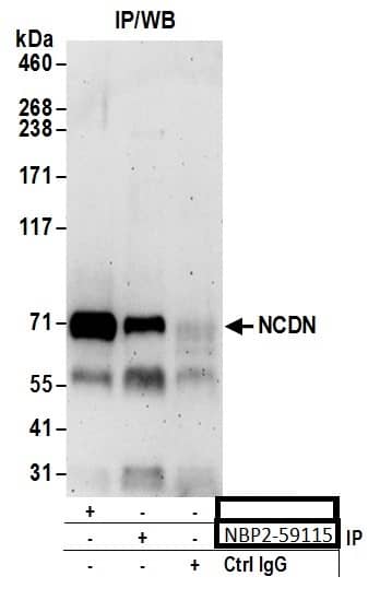 Immunoprecipitation;Neurochondrin Antibody  Whole cell lysate (0.5 or 1.0 mg per IP reaction; 20% of IP loaded) from 293T cells prepared using NETN lysis buffer. Antibodies: Affinity purified rabbit anti-NCDN antibody  used for IP at 6 µg per reaction. NCDN was also immunoprecipitated by rabbit anti-NCDN antibody. For bting immunoprecipitated NCDN, was used at 0.4 mg/ml. Detection: Chemiluminescence with an exposure time of 3 minutes.