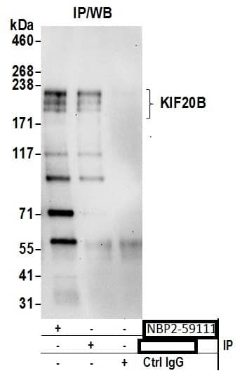 Immunoprecipitation;MPHOSPH1 Antibody  Whole cell lysate (0.5 or 1.0 mg per IP reaction; 20% of IP loaded) from 293T cells prepared using NETN lysis buffer. Antibodies: Affinity purified rabbit anti-KIF20B antibody  used for IP at 6 µg per reaction. KIF20B was also immunoprecipitated by rabbit anti-KIF20B antibody. For bting immunoprecipitated KIF20B,  was used at 0.4 mg/ml. Detection: Chemiluminescence with an exposure time of 30 seconds.