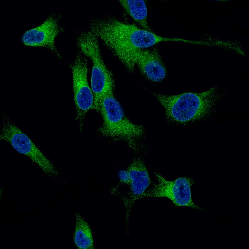 Staining of SK-MEL-30 cells, showing specific staining in endoplasmic reticulum in green. Nuclear probes is visualized in blue (where available).