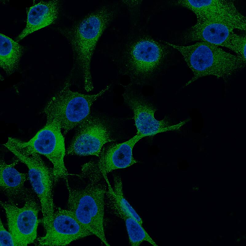 Staining of SK-MEL-30 cells, showing specific staining in endoplasmic reticulum in green. Nuclear probes are visualized in blue (where available).