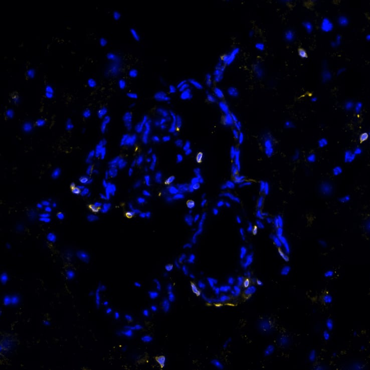 STING was detected in frozen sections of mouse choroid plexus using Rabbit Anti-Mouse STING Monoclonal Antibody (Catalog # NBP3-18816) at 10ug/mL at 37 ° Celsius for 4 minutes. Before incubation with the primary antibody, tissue underwent preprocessing by incubating tissue with Multi Staining Buffer (Lunaphore Catalog # BU06) for 5minutes at room temperature followed by a 20-minute incubation in Tris-Buffered Saline + 0.2% Triton at room temperature. Tissue was stained using the Alexa Fluor™ Plus 647 Goat anti-Rabbit IgG Secondary Antibody at 1:200 at 37 ° Celsius for 2 minutes. (Yellow; Lunaphore Catalog # DR647RB) and counterstained with DAPI (blue; Lunaphore Catalog # DR100). Specific staining was localized to the cytoplasm. Protocol available in COMET™ Panel Builder.