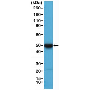 Western Blot: Cytokeratin 17 Antibody (RM351) [NBP3-18824] - Western Blot of HeLa cell lysate using Clone RM351 at a  1:10000 dilution.
