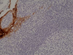 Immunohistochemistry: Cytokeratin 4 Antibody (RM355)[NBP3-18825]Immunohistochemical staining of formalin fixed and paraffin embedded human tonsil tissue section using anti-CK-4 rabbit monoclonal antibody (Clone RM355) at a 1:1000 dilution.