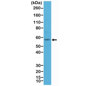 Western Blot: Cytokeratin 4 Antibody (RM355) [NBP3-18825] - Western Blot of A431 cell lysate using Clone RM355 at a 1:100 dilution.