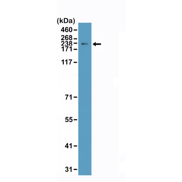Western Blot: TOP2A Antibody (RM394) [NBP3-18827] - Western Blot of HeLa cells lysate using Clone RM394 at a 1:2000 dilution.