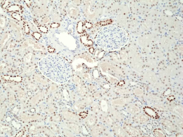 Immunohistochemistry: PAX8 Antibody (RM436)[NBP3-18831]Immunohistochemical staining of formalin fixed and paraffin embedded human Kidney tissue section using anti-Paired box protein Pax-8 rabbit monoclonalantibody (Clone RM436) at a 1:400 dilution.