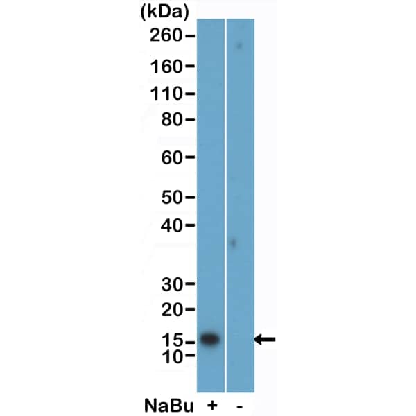 Western Blot: Histone H2B [ac Lys5] Antibody (RM455) [NBP3-18842] - Western Blot of acid extracts of HeLa cells treated (+) or untreated (-) with sodium butyrate, using Clone RM455 at 0.02 ug/mL.