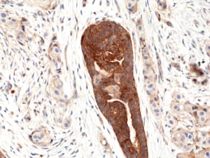 Immunohistochemistry VEGF 165 Antibody (RM391)