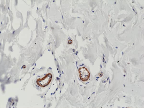 Immunohistochemistry-Paraffin: VEGF 165 Antibody (RM391) [NBP3-18846] - Immunohistochemical staining of formalin fixed and paraffin embedded human breast tissue section using Clone RM391 at a 1:200 dilution.