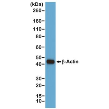 Western Blot: beta-Actin Antibody (RM112)[NBP3-18847]Western blot of A431 cells, using anti-beta -Actin RevMAb Clone RM112 at a 1/1000 dilution, showed a band of  beta -Actin at the predicted MW (42 kDa).