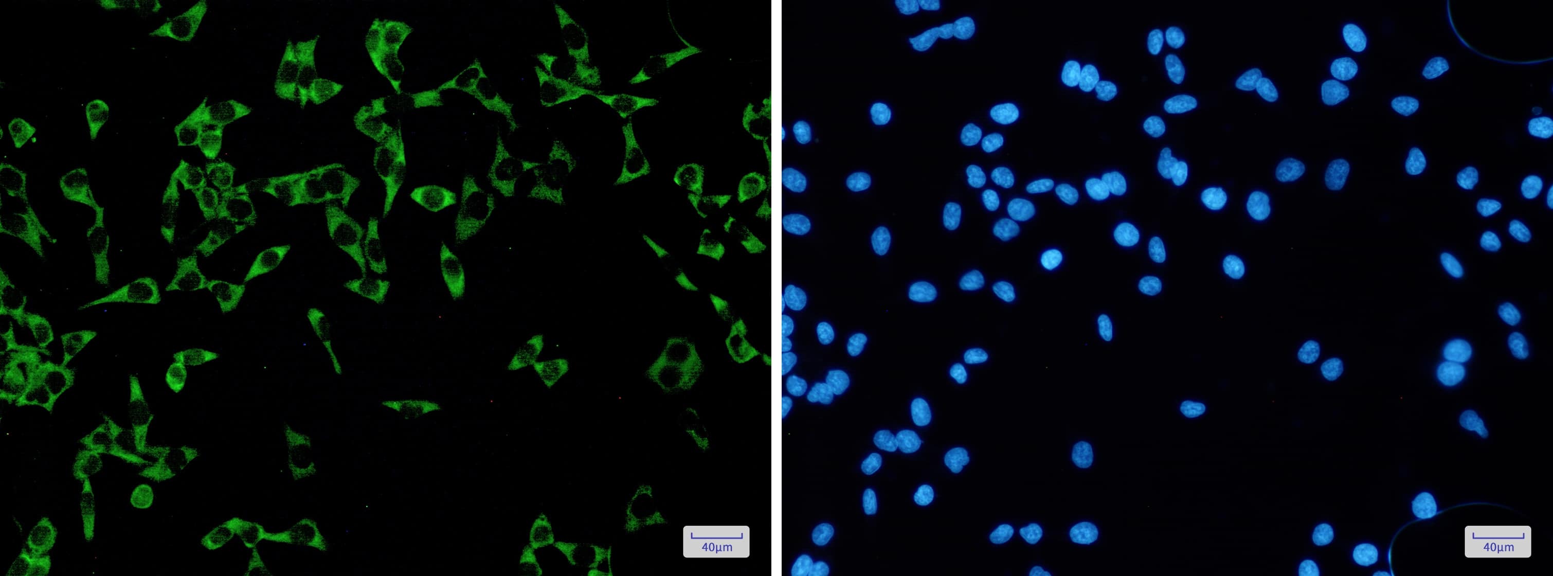 Immunocytochemistry/Immunofluorescence: FMRP Antibody (S08-5G5) [NBP3-19487] - Immunofluorescence of FMRP (green) in Hela using NBP3-19487 at dilution 1/5, and DAPI (blue)