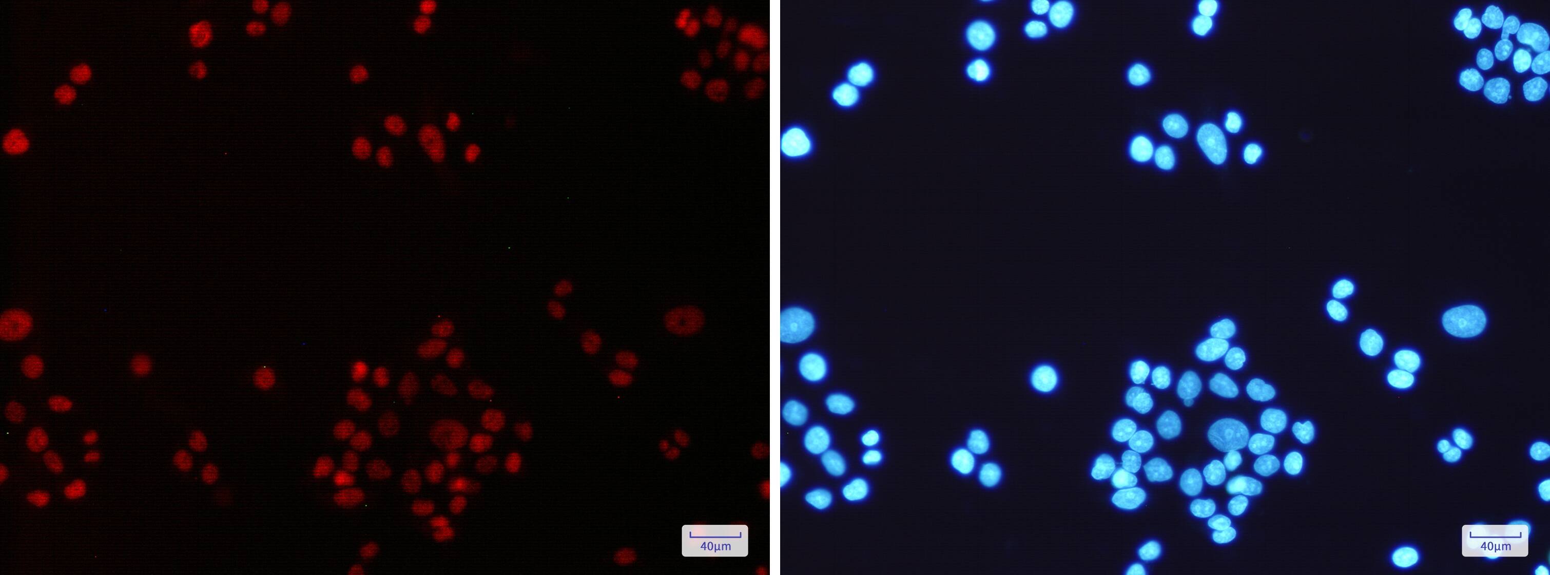 Immunocytochemistry/Immunofluorescence: MLH1 Antibody (S02-2E8) [NBP3-19527] - Immunofluorescence of MLH1 in Hela cells using NBP3-19527 at dilution 1/200, and DAPI (blue)