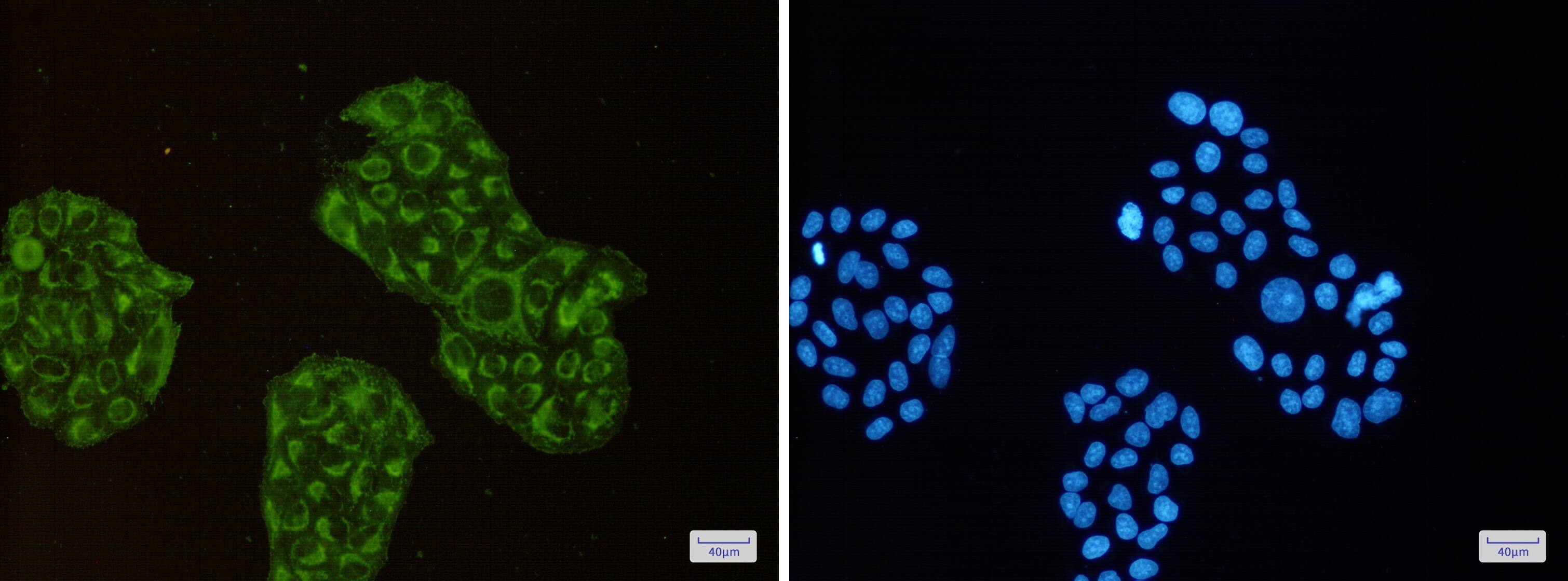 Immunocytochemistry/Immunofluorescence: ACADM Antibody (S06-8F7) [NBP3-19554] - Immunofluorescence of ACADM (green) in Hela cells using NBP3-19554 at dilution 1/50, and DAPI (blue)