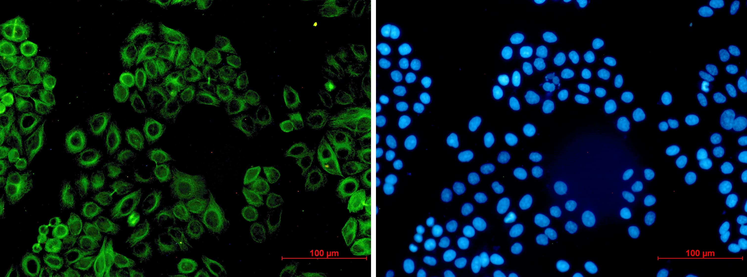 Immunocytochemistry/ Immunofluorescence: Activin RIB/ALK-4 Antibody (S08-8D6) [NBP3-19558] - Immunofluorescence of Activin RIB/ALK-4 (green) in hela using NBP3-19558 at dilution 1/50, and DAPI(blue)