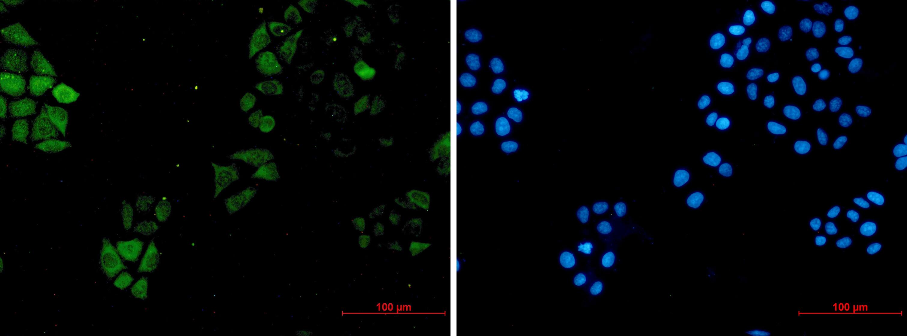 Immunocytochemistry/Immunofluorescence: S100A4 Antibody (S01-7H1) [NBP3-19607] - Immunocytochemistry of S100A4 (green) in hela using NBP3-19607 at dilution 1/5, and DAPI (blue)