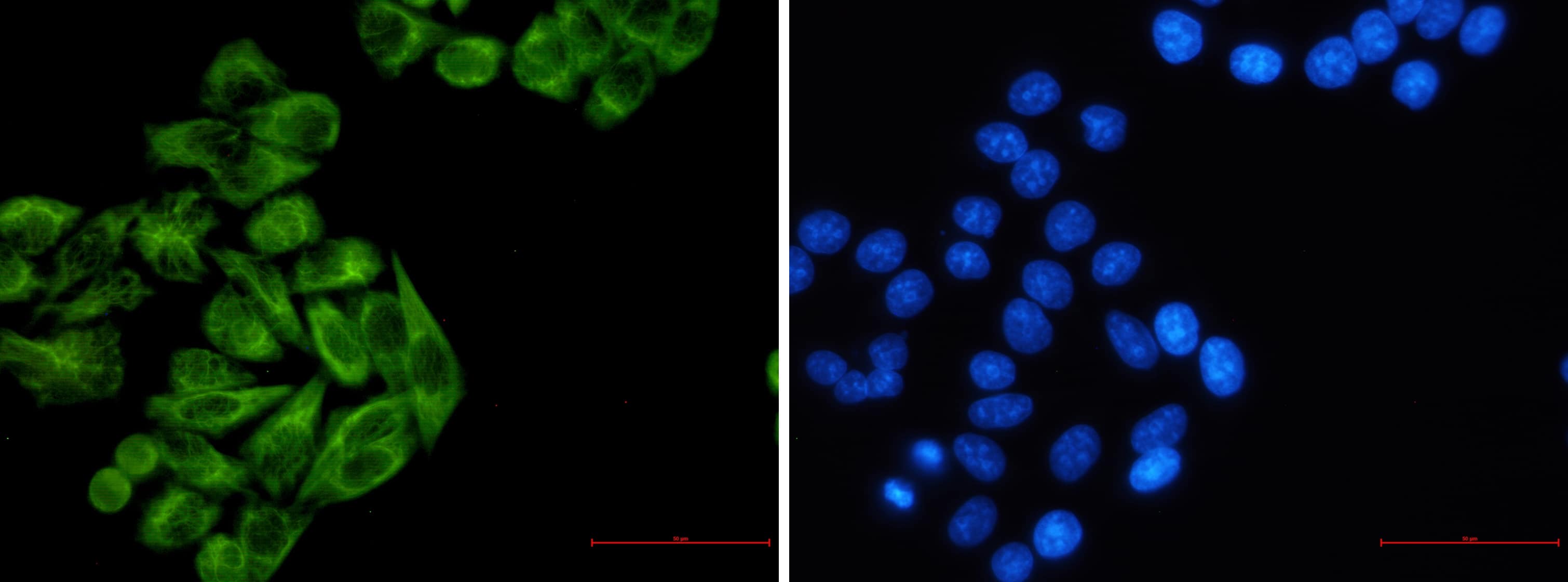 Immunocytochemistry/Immunofluorescence: Cytokeratin 7 Antibody (S03-2E7) [NBP3-19617] - Immunofluorescence of Cytokeratin 7 (green) in Hela using NBP3-19617 at dilution 1/5, and DAPI (blue)