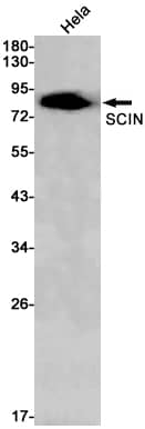 Western Blot SCIN Antibody (S07-6G2)