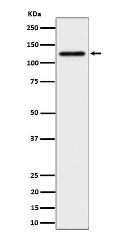 Western Blot: SPINK5 Antibody (S06-6C1) [NBP3-19779] - Western blot analysis of SPINK5 expression in HeLa cell lysate. 