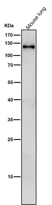 Western Blot: SPINK5 Antibody (S06-6C1) [NBP3-19779] - All lanes use NBP3-19779 at 1:1000 dilution for 1 hour at room temperature. 