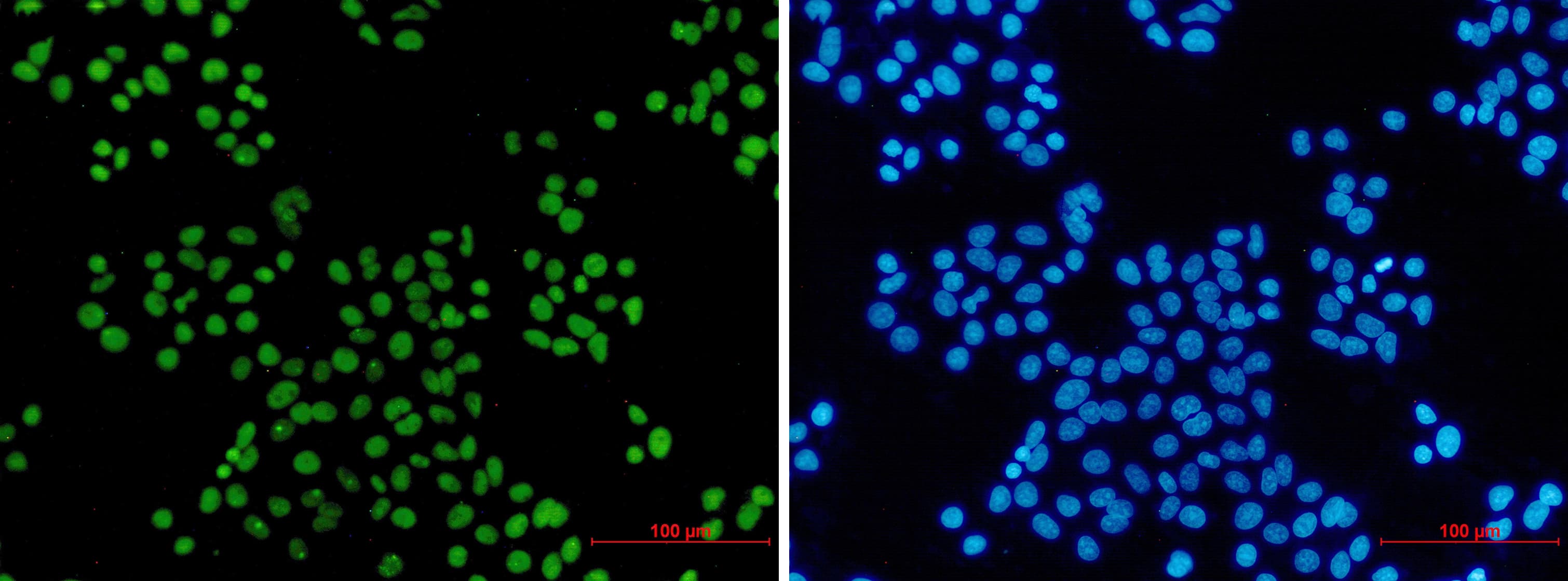 Immunocytochemistry/Immunofluorescence: MCM2 Antibody (S02-0D3) [NBP3-19887] - Immunocytochemistry of MCM2 (green) in hela using NBP3-19887 at dilution 1/5, and DAPI (blue)