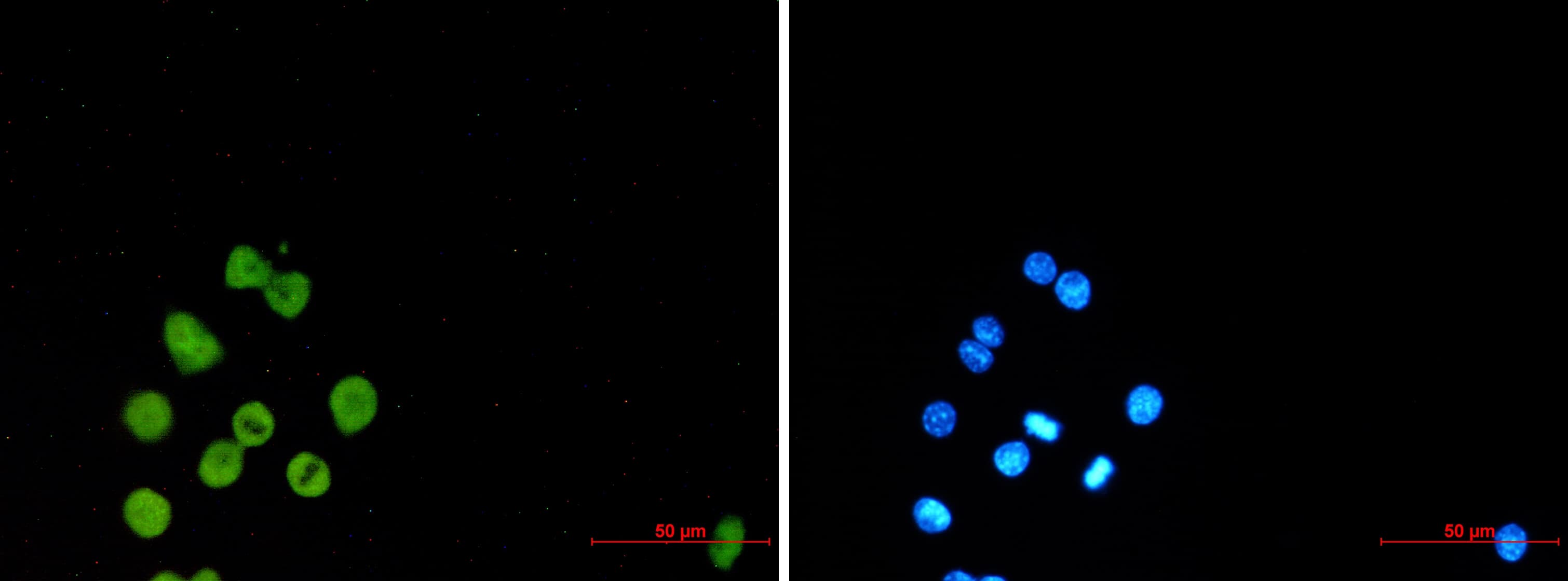 Immunocytochemistry/Immunofluorescence: PU.1/Spi-1 Antibody (S02-1D7) [NBP3-19911] - Immunocytochemistry of PU.1/Spi1 (green) in Raw264. 7 using NBP3-19911 at dilution 1/50, and DAPI (blue)