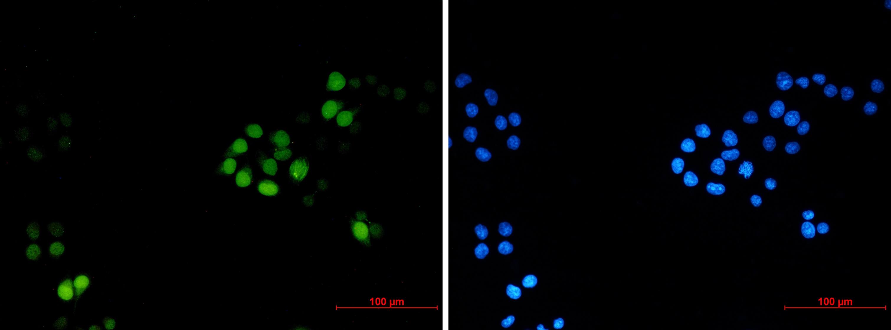 Immunocytochemistry/Immunofluorescence: TPX2 Antibody (S01-8A6) [NBP3-19922] - Immunocytochemistry of TPX2 (green) in Hela using NBP3-19922 at dilution 1/2, and DAPI (blue)