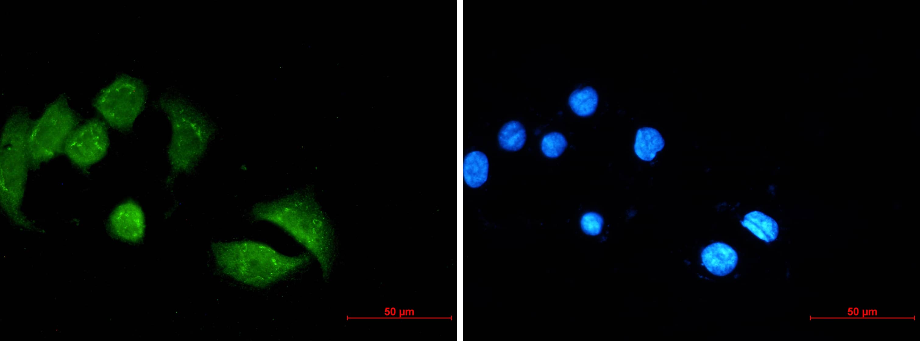 Immunocytochemistry/Immunofluorescence: UBE4B Antibody (S04-6C6) [NBP3-19924] - Immunocytochemistry of UBE4B (green) in MCF-7 using NBP3-19924 at dilution 1/20, and DAPI (blue)