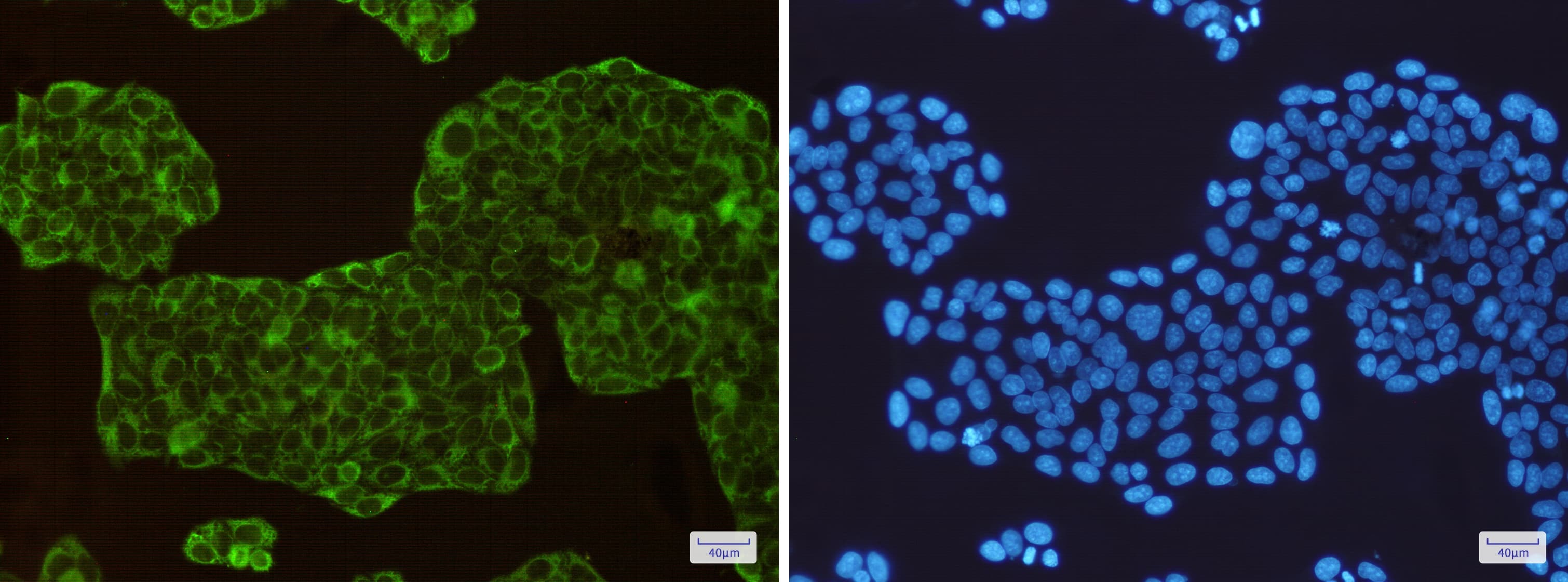 Immunocytochemistry/Immunofluorescence: Argininosuccinate Synthase Antibody (S02-7A8) [NBP3-19945] - Immunofluorescence of Argininosuccinate Synthase (green) in Hela cells using NBP3-19945 at dilution 1/200, and DAPI (blue)