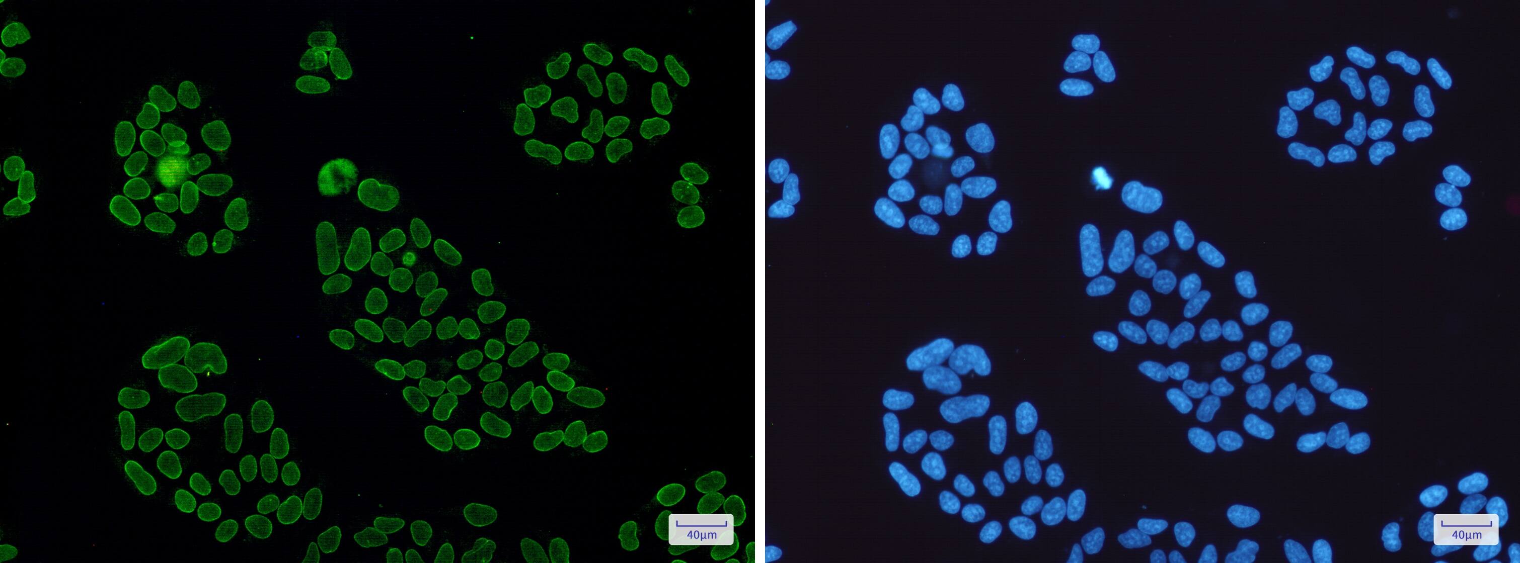 Immunocytochemistry/Immunofluorescence: Lamin A + C Antibody (S06-7H5) [NBP3-19963] - Immunofluorescence of Lamin A + C (green) in Hela cells using NBP3-19963 at dilution 1/50, and DAPI (blue)