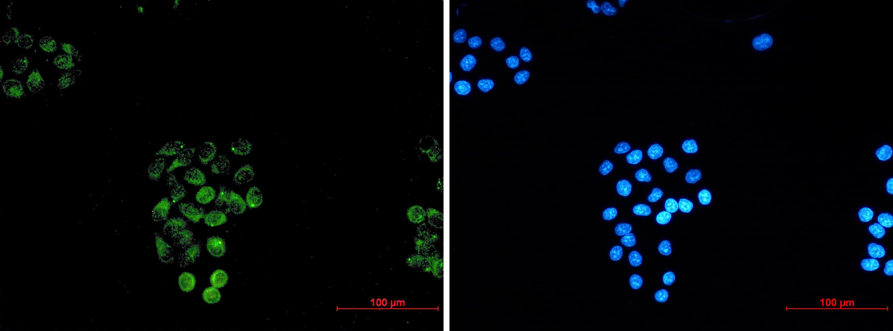 Immunocytochemistry/Immunofluorescence: RASEF Antibody (S03-1G6) [NBP3-19968] - Immunocytochemistry of RASEF (green) in Hela using NBP3-19968 at dilution 1/20, and DAPI (blue)