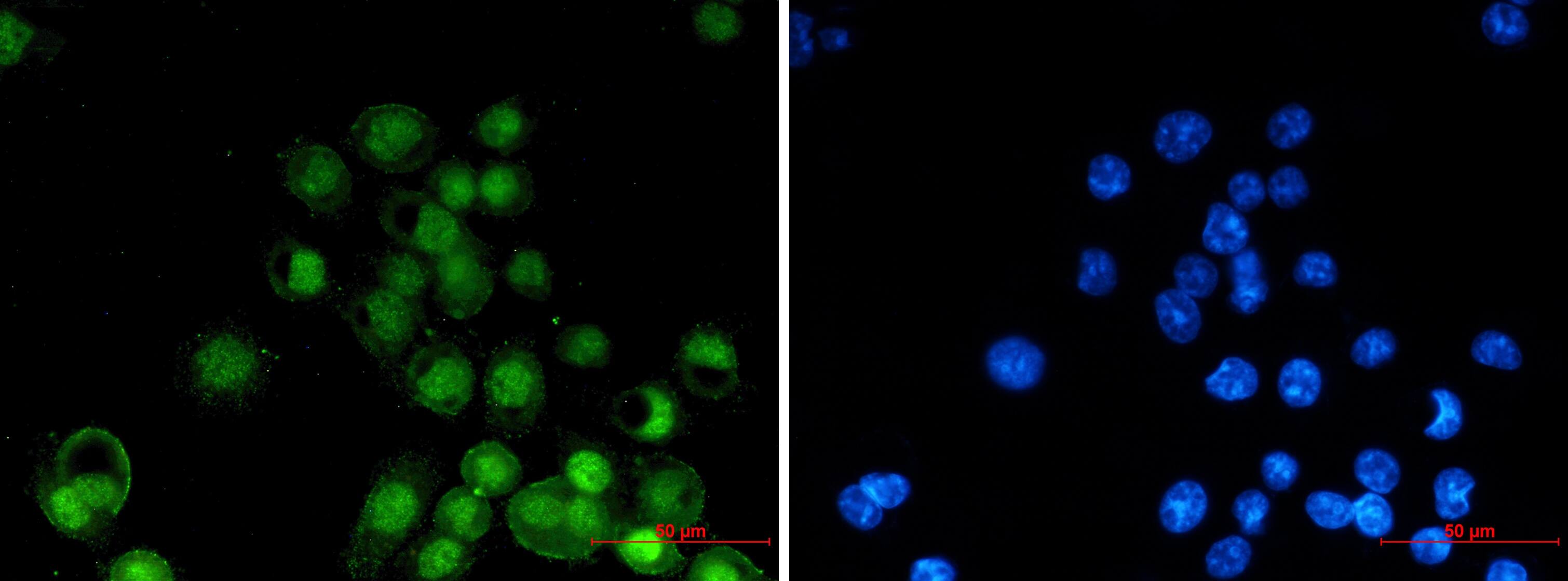 Immunocytochemistry/Immunofluorescence: RXR alpha/NR2B1 Antibody (S04-6C3) [NBP3-19972] - Immunocytochemistry of RXR alpha/NR2B1 (green) in MCF-7 using NBP3-19972 at dilution 1/20, and DAPI (blue)