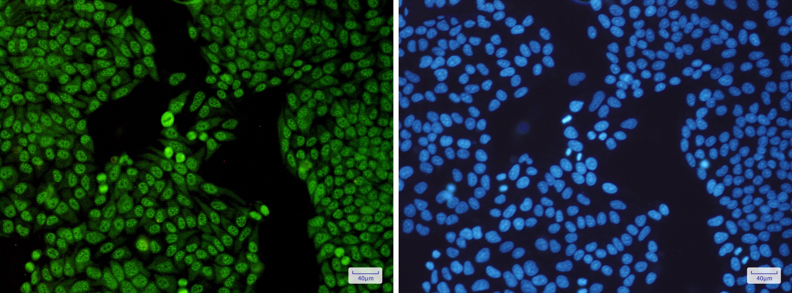 Immunocytochemistry/Immunofluorescence: SAP130 Antibody (S07-2K8) [NBP3-19974] - Immunocytochemistry of SAP130 (green) in Hela cells using NBP3-19974 at dilution 1/50, and DAPI (blue)