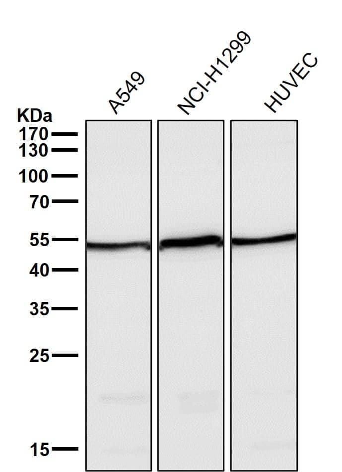 Western Blot: Angiopoietin-2 Antibody (S04-7E6) [NBP3-20029] - All lanes use NBP3-20029 at 1:6000 dilution for 1 hour at room temperature. 