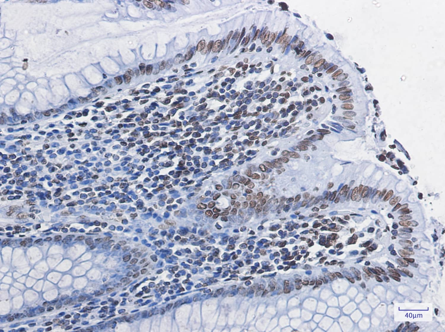 Immunohistochemistry-Paraffin: Histone H4 Antibody (S05-8H9) [NBP3-20040] - Immunohistochemistry of paraffin-embedded Human colon cancer tissue using NBP3-20040 at dilution 1/100