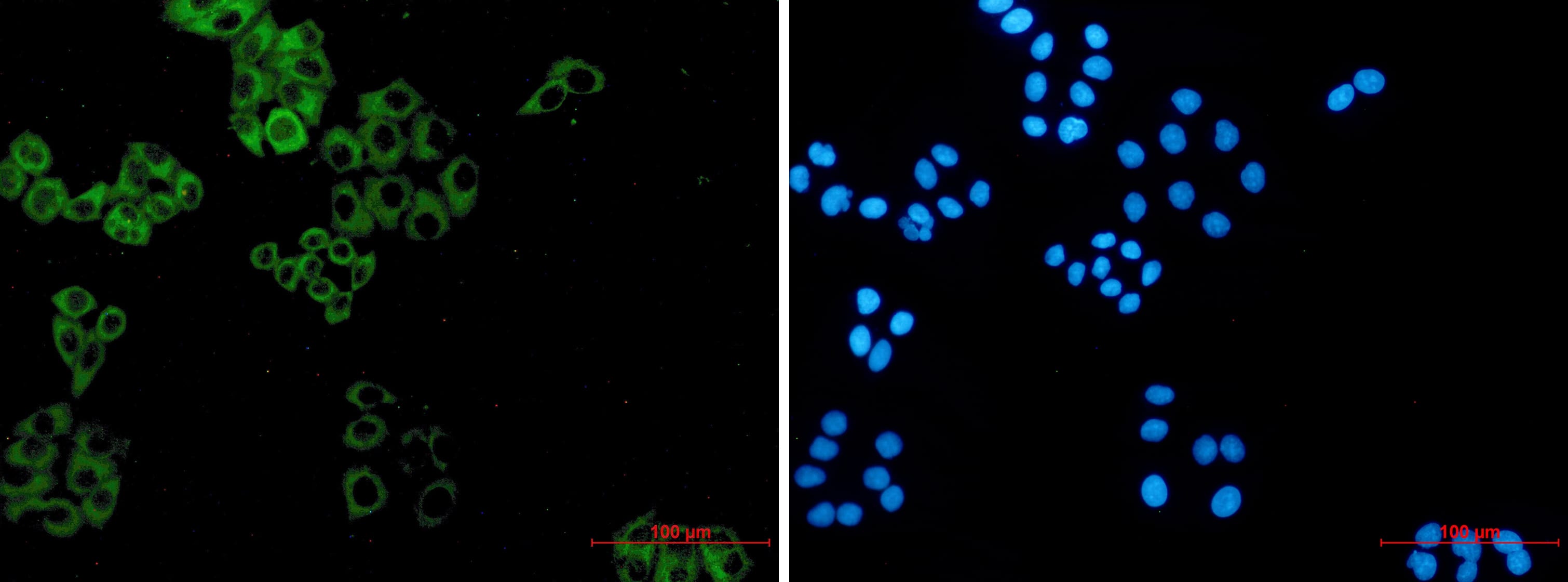 Immunocytochemistry/Immunofluorescence: Paxillin Antibody (S04-3C3) [NBP3-20046] - Immunofluorescence of Paxillin (green) in hela using NBP3-20046 at dilution 1/5, and DAPI (blue)