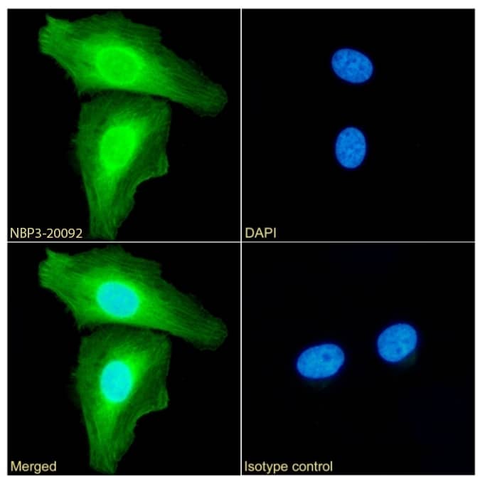 Immunocytochemistry/Immunofluorescence: Annexin A1 Antibody (SAIC-13B-19) - Azide and BSA Free [NBP3-20092] - Immunofluorescence analysis of paraformaldehyde fixed HeLa cells permeabilized with 0.15% Triton stained with the chimeric rabbit IgG version of SAIC-13B-19 (NBP3-20092) (1:100 dilution) for 1h followed by Alexa Fluor(R) 488 secondary antibody (1:1000 dilution), showing cytoplasmic staining. The nuclear stain is DAPI (blue). Panels show from left-right, top-bottom NBP3-20092, DAPI, merged channels and an isotype control. The isotype control was an unknown specificity antibody followed by staining with Alexa Fluor(R) 488 secondary antibody.